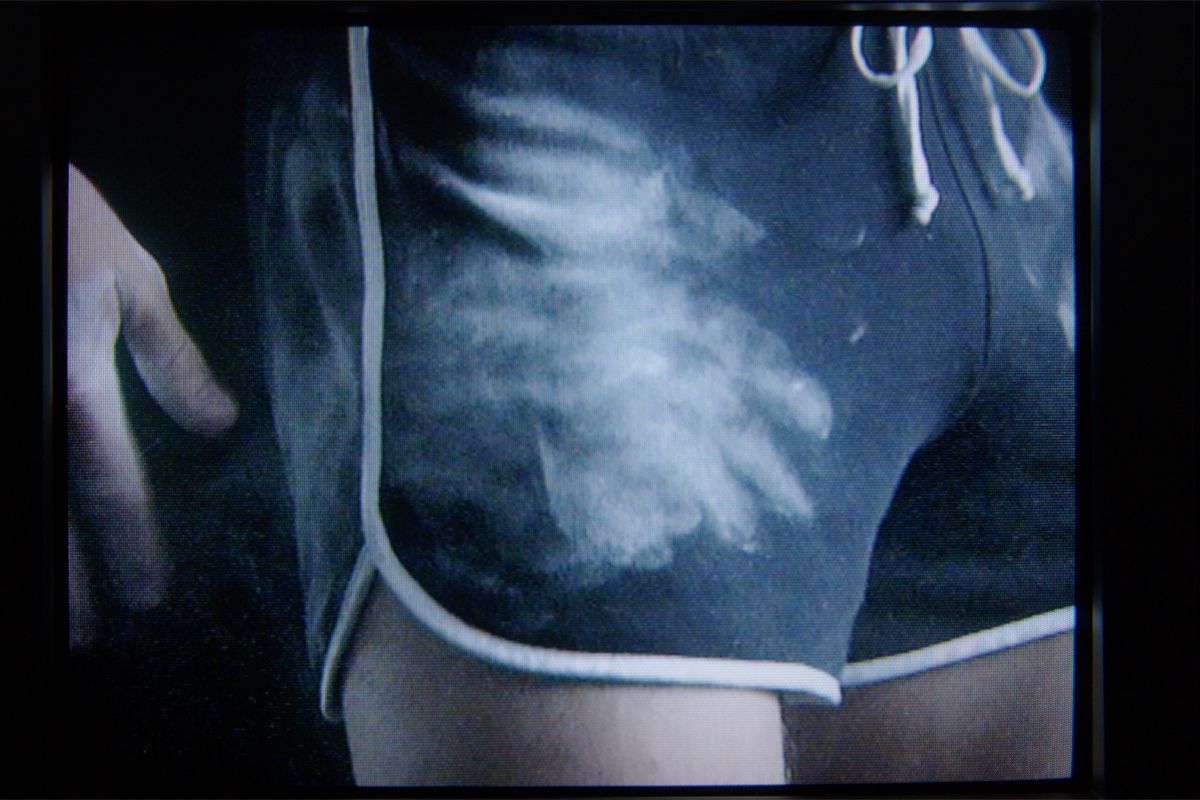 Frame 17